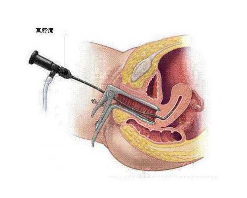 供卵中心名单_供卵试管婴儿论坛_试管婴儿治疗都需要哪些过程?