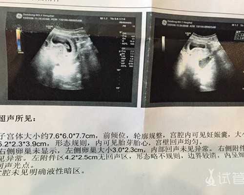 试管移植期前吃PQQ真的能提高卵子质量吗?