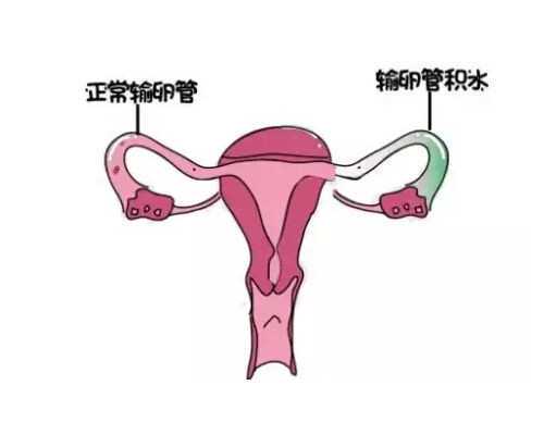 温州供卵试管代怀 温州三代试管包生男孩价格多少？十万够吗？ ‘32周双顶径
