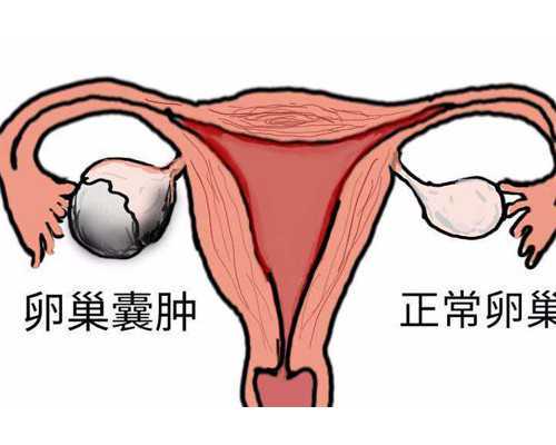 合肥哪里做代孕最权威,46岁高龄做试管婴儿机会大吗?