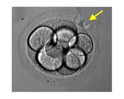 供卵自怀孩子像谁_正规供卵医院_梗阻性无精症可以做试管婴儿吗?
