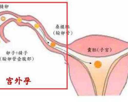 西安交大二附院生殖科谁有名?李向红医生怎么样?