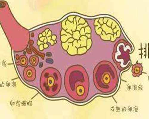 广州精子库的精子做人工授精生孩子要花多少钱?