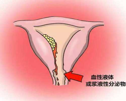 供卵助孕的孩子_供卵试管有谁做过_试管婴儿双胞胎减胎风险有哪些?了如指掌