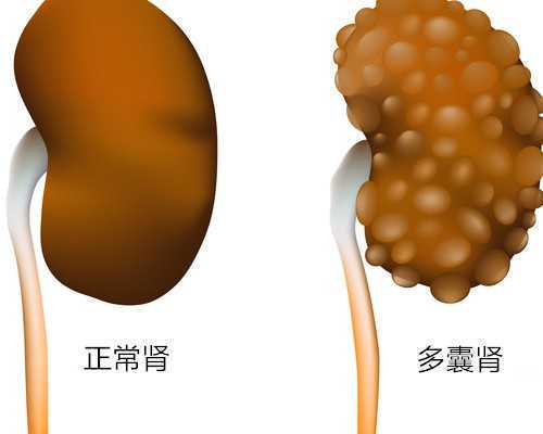 试管移植失败后应该做什么