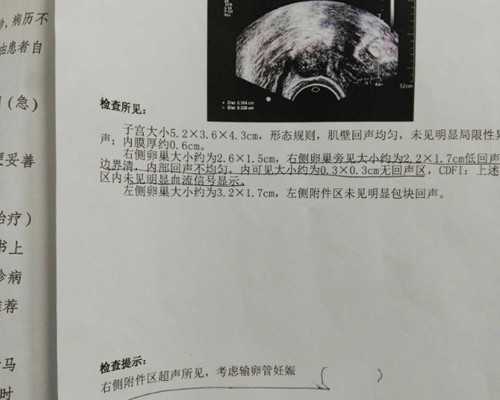 合肥代生生子价格,做海外试管婴儿选第几代比较合适?_合肥做试管婴儿一次多少